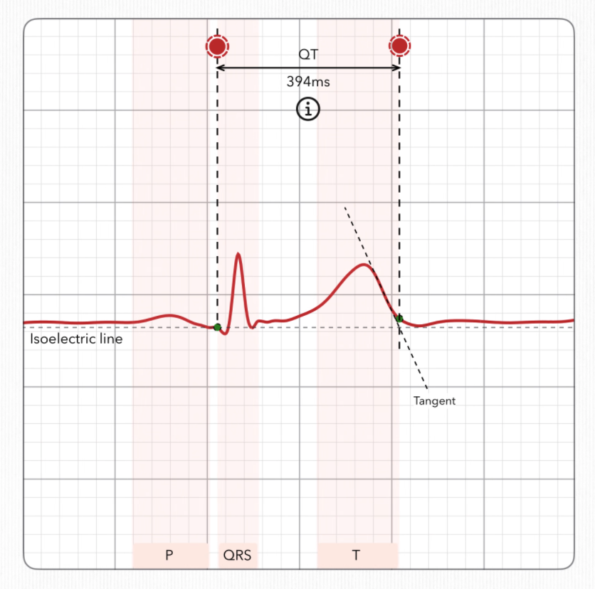 ECG heartbeat diagram showing the QT interval measured from the Q wave to the end of the T wave