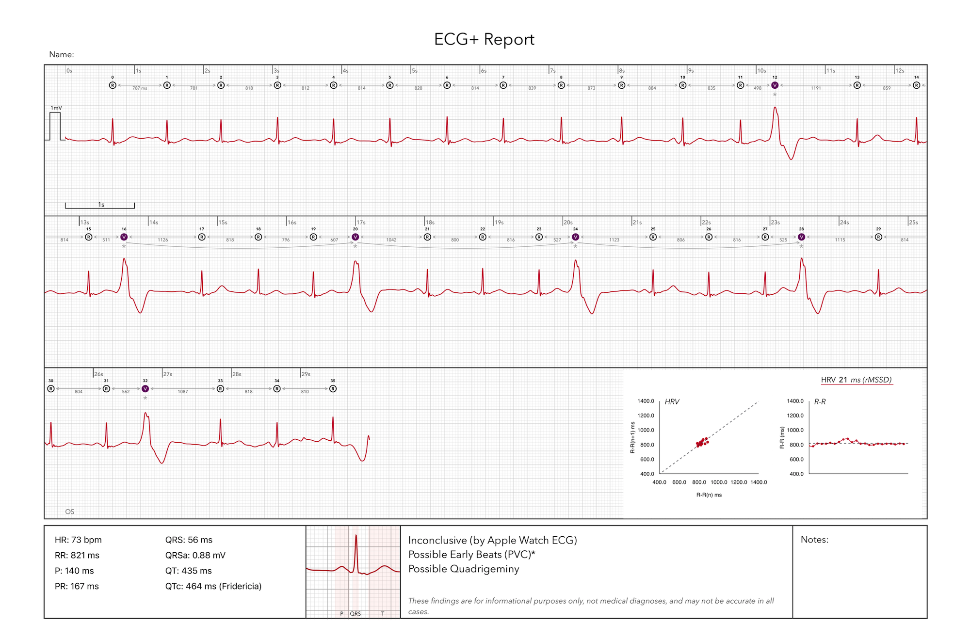 ECG+ report showing Apple Watch ECG findings ready to share with a doctor