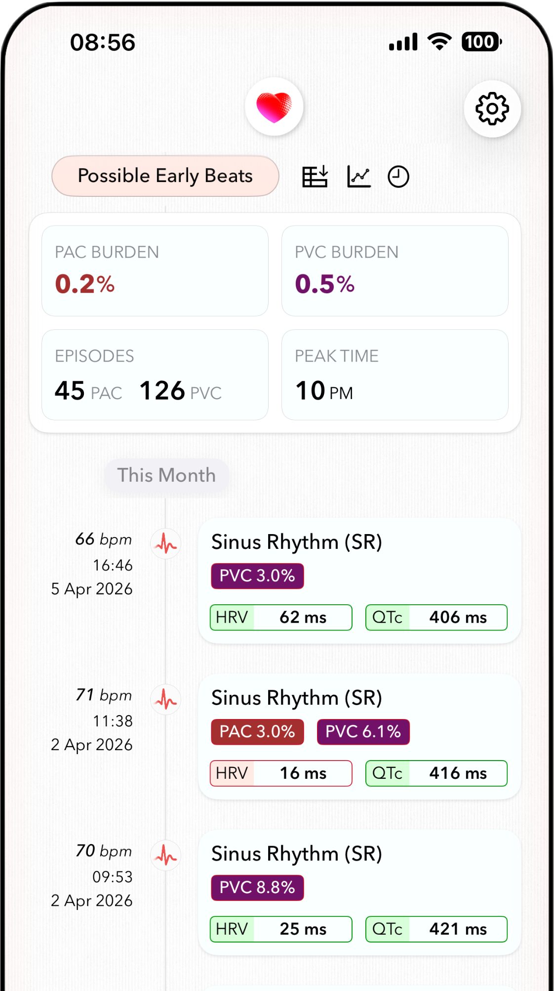 ECG+ app screenshot showing PAC burden calculated for Apple Watch ECG recordings